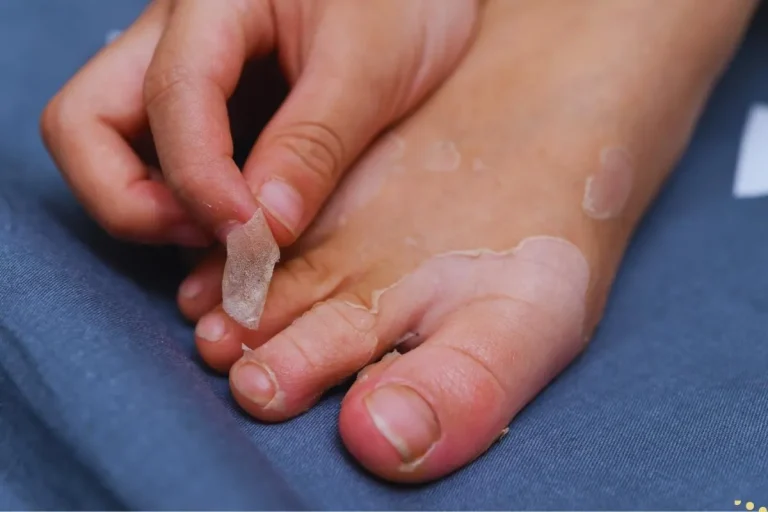 what-is-the-spiritual-meaning-of-peeling-skin-of-hands-and-feet